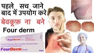 Four Derm  cream review | benefits and side effects use in hindi #fourderm #cream #youtube