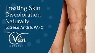 Treating Skin Discoloration Naturally | Latrese Andre, PA-C
