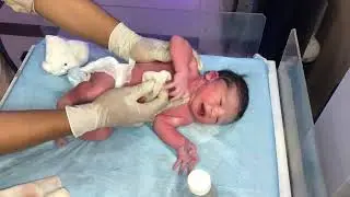 Part1 Newborn Baby Receive in Labor Room Suction Needed Skin Cleaning NICU Care & Initial Assessment