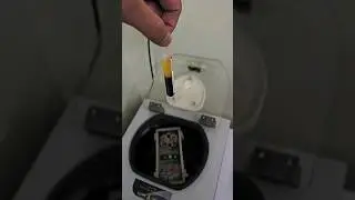 blood plasma separation process  #shorts #centrifuge