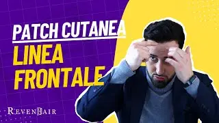 PATCH CUTANEA PARZIALE [Per linea frontale, stempiature, piccole zone] | Protesi capelli