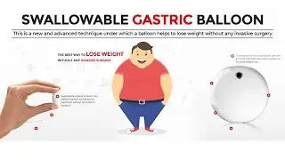 Swallowable Gastric Balloon, Elipse, Allurion Balloon, Pill, Side Effects, Reviews, Cost in India