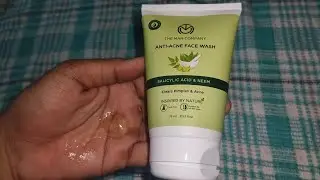The Man Company Anti Ance Facewash Honest Review