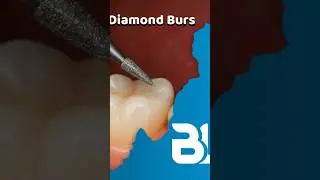 💙 𝗕𝗟𝗨 Diamond Burs 💙.     Precision you can trust