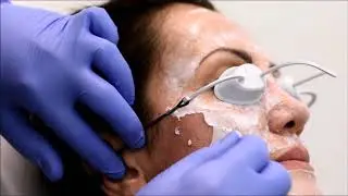 Smeraglia Luxury Clinic - Resurfacing