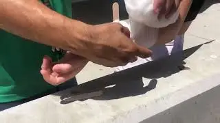 Bandaging An Impaled Object