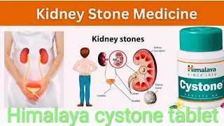 Kidney stone medicine | Himalaya Cystone tablet full review in hindi