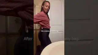 Before vs After Emptying My Ostomy Bag | The REAL DEAL
