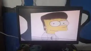 Edit de prepucio Lopez