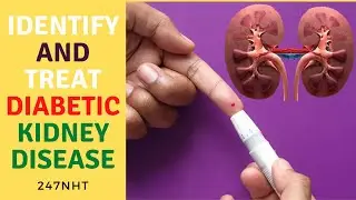 Identify And Treat Diabetic Kidney Disease - Can you reverse kidney damage from diabetes? | 247nht