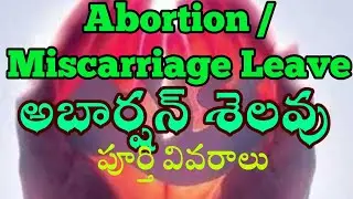 Abortion Leave Miscarriage Leave Rules Guide Women Employees 42 Days Abortion Leave #Abortion_Leaves