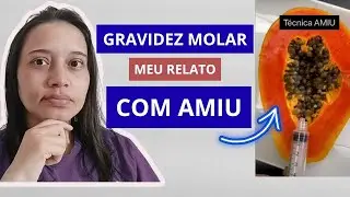 Como foi fazer o procedimento AMIU | Meu relato | Gravidez Molar | Mola Hidatiforme | Parte 03