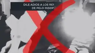 X&ocirc; Pelos, Removedor de pelos da sua roupa, cama, sofa, ch&atilde;o na casa toda