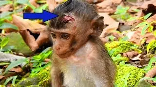 Break My Heart!  Baby Lori Get Hurt On Head Again | A Chap Bit Baby Lori This Morning ,Amari Go Away
