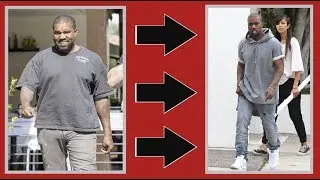 KANYE WEST HAD LIPOSUCTION!!! 🤯