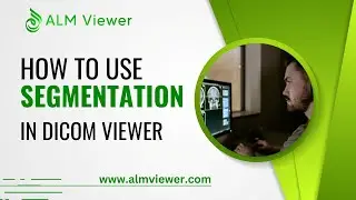 Segmentation Tool in Dicom Viewer - By Alm Viewer