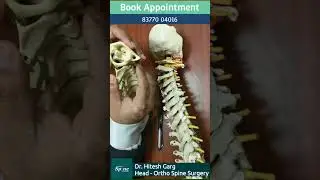 What is C1-C2 instability instability? Cervical Spine Surgeon in India | Spine Doctor in Gurgaon
