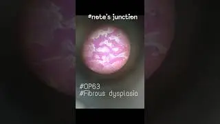 # Oral pathology slides # BDS 3 year