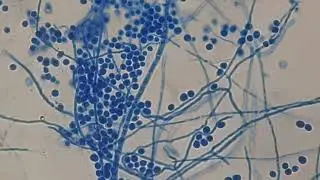 Conidia and hyphae of Aspergillus in LPCB of Cornmeal agar