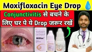 Conjunctivitis treatment । Conjunctivitis disease ।  Moxifloxacin eye drops uses hindi । Moxi Drops