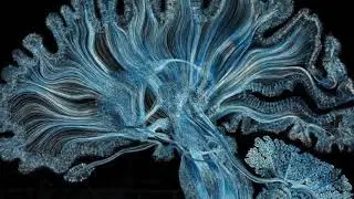 extreme left brain intelligence