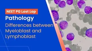 Pathology - Differences between Myeloblast and Lymphoblast