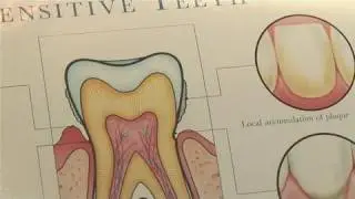 How To Deal With Sensitive Teeth