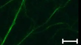 Movie 2. Time-series of GFP&ndash;Lifeact-tagged actin cytoskeleton