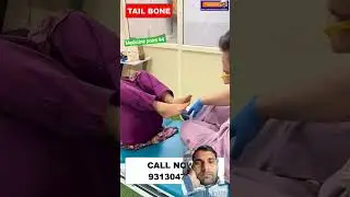 tail bone 🦴 pain treatment #doctor #chiropractor #delhi #hospital #tailbone #ytshorts #india #trend
