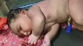 Newborn baby breathing problem #adorably #cutebaby #problem #baby #serious 
