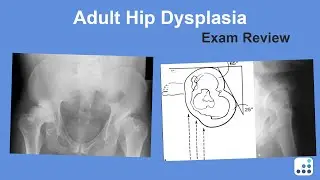 Adult Hip Dysplasia Exam Review - William Jiranek, MD