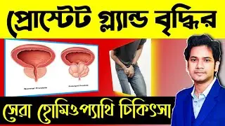 Homeopathic Treatment of Prostate Enlargement or BPH | প্রোস্টেট বৃদ্ধির সেরা চিকিৎসা |