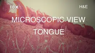 MICROSCOPIC VIEW - TONGUE