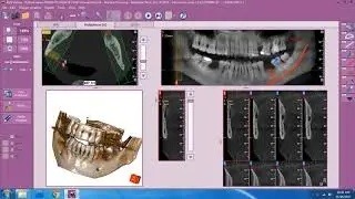 Insights Diagnostic - iRys Software Tutorial Video - Opening and Copying Files