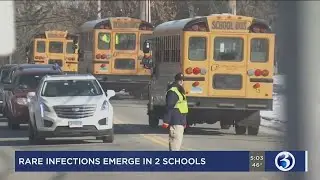 VIDEO: Rare infections emerge in two separate CT school districts