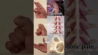yoga mudars #kidneypain #nackpain #mindset #ytshortsindia #yogaforbeginners #yogamudra