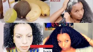 ቻሌንጅ ቑ-7#eritrea #hair growth challenge day7 @ግርማዊት @gualkeren @solomedia9376 @gDrar