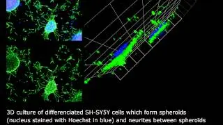 HCSPharma : 3D culture of differenciated SH-SY5Y cells