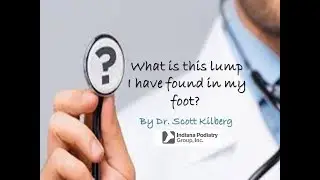 What is this lump I have found in my foot?
