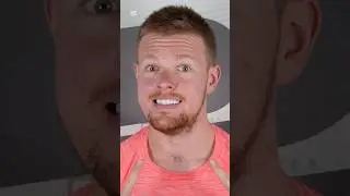 Kyle Got 20 Zirconium Crowns in Turkey 🇹🇷🦷 | Smile TRANSFORMATION!