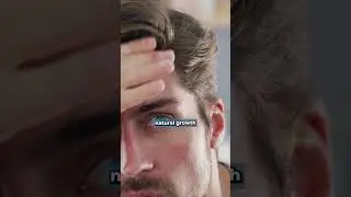 Hair Shedding or Hair Loss