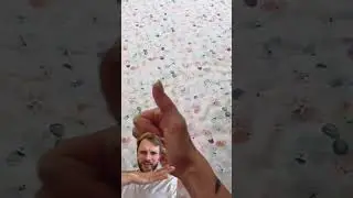 Hand hypermobility: Doctor teaches you how to detect it ✅ #reaction