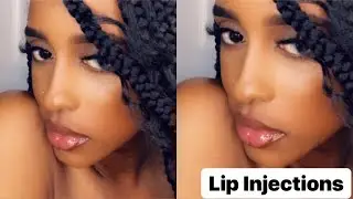 FAKE LIP INJECTIONS AT HOME (how to get big lips)