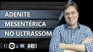 COMO RECONHECER ADENITE MESENTÉRICA NO ULTRASSOM