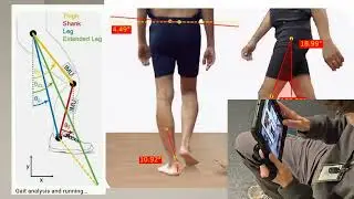 Gait Analysis 