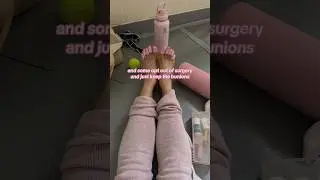 BUNIONS IN BALLET #bunion#ballerina#ballet#surgery#dancer#didyouknow#funfact#explained