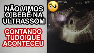 🥺NÃO CONSEGUIMOS VER O BEBÊ NA ULTRASSOM | SEMANAS 4,5,6,7,8 E 9 DE GRAVIDEZ