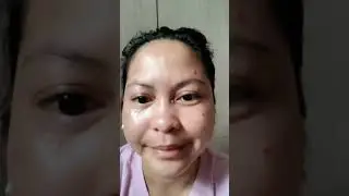 KASOY OIL  MOLE REMOVAL  / effective nga ba?