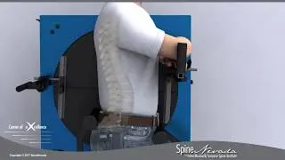View spinal motion like a movie &mdash; Vertebral Motion Analysis (VMA) for Lumbar spine