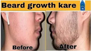Coconut oil before and after beard growth | coconut oil for beard growth